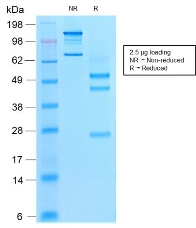 Villin Recombinant Monoclonal Mouse Antibody (rVIL1/1325)