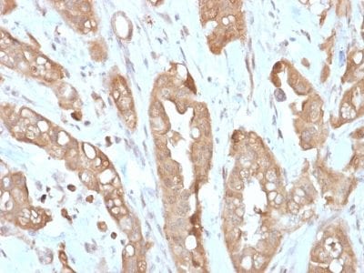 Villin Recombinant Monoclonal Rabbit Antibody (VIL1/2310R)
