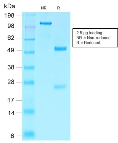 Villin Recombinant Monoclonal Rabbit Antibody (VIL1/2310R)