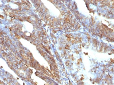 Vimentin Monoclonal Mouse Antibody (V9)
