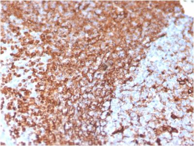 Vimentin Monoclonal Mouse Antibody (VIM/3736)