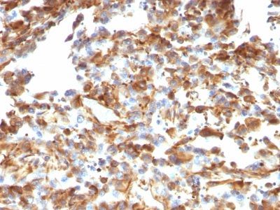 Vimentin Monoclonal Mouse Antibody (VM1170)