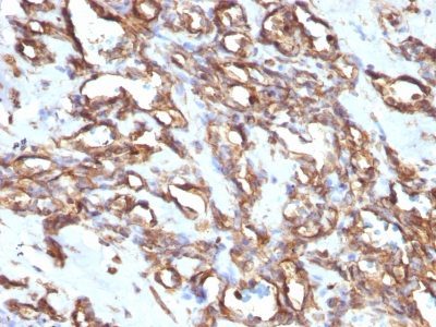 Vimentin Monoclonal Mouse Antibody (VM1170)