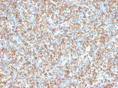 Vimentin Monoclonal Mouse Antibody (VM1170)