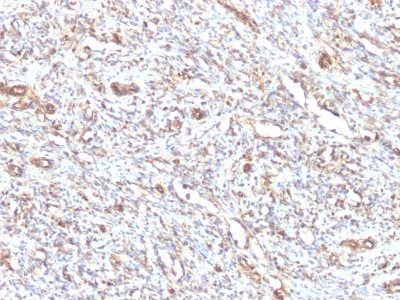 Vimentin Monoclonal Mouse Antibody (VM1170)