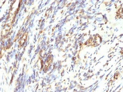 Vimentin Monoclonal Mouse Antibody (VM1170)