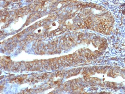 Vimentin Monoclonal Mouse Antibody (VM1170)