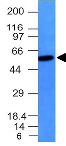 Vimentin Monoclonal Mouse Antibody (VM452)
