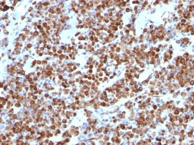 Vimentin Monoclonal Mouse Antibody (VM452)
