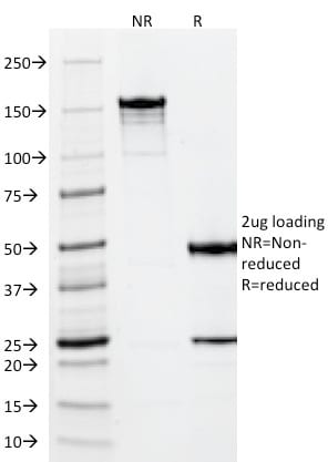 Vimentin Monoclonal Mouse Antibody (VM452)