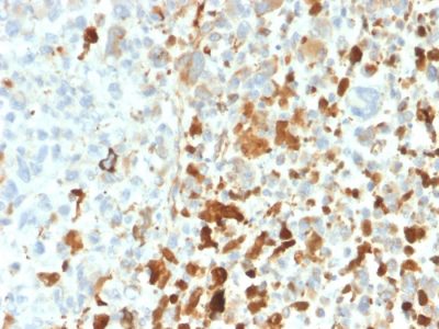 Vimentin Recombinant Monoclonal Rabbit Antibody (VIM/1937R)
