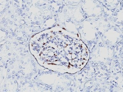 Wilm’s Tumor 1 / WT1 Monoclonal Mouse Antibody (6F-H2)