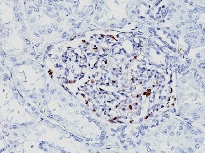 Wilm’s Tumor 1 / WT1 Monoclonal Mouse Antibody (WT1/857 + 6F-H2)