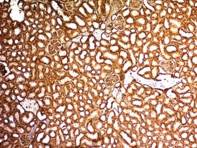 Wilm’s Tumor 1 / WT1 Monoclonal Mouse Antibody (WT1/857 + 6F-H2)