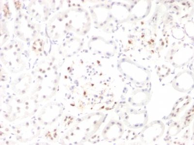 Wilm’s Tumor 1 / WT1 Monoclonal Mouse Antibody (WT1/857 + 6F-H2)