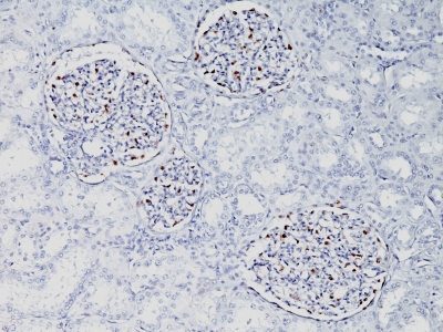Wilm’s Tumor 1 / WT1 Monoclonal Mouse Antibody (WT1/857)
