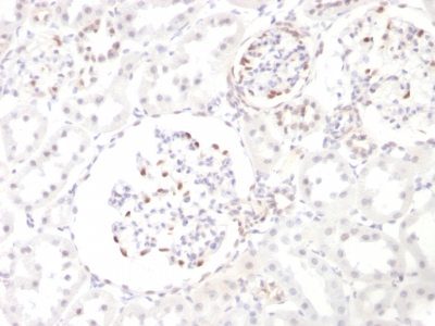 Wilm’s Tumor 1 / WT1 Monoclonal Mouse Antibody (WT1/857)