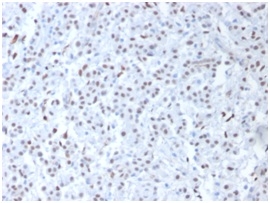 Wilm’s Tumor 1 / WT1 Polyclonal Rabbit Antibody