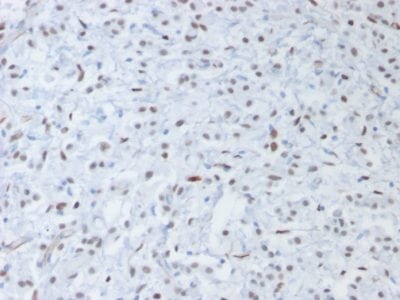 Wilm’s Tumor 1 / WT1 Recombinant Monoclonal Mouse Antibody (rWT1/857)