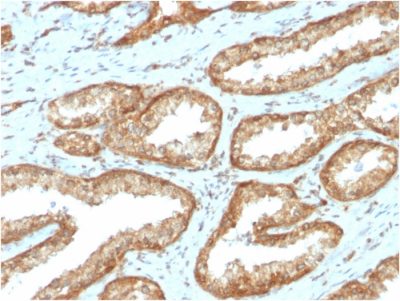 YBX1 / Y-box Binding Protein 1 / YB-1 Monoclonal Mouse Antibody (YBX1/2430)