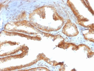 YBX1 / Y-box Binding Protein 1 / YB-1 Recombinant Monoclonal Mouse Antibody (rYBX1/2430)