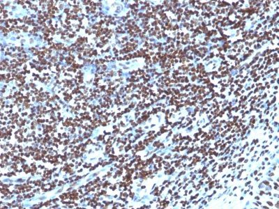 Histone H1 Monoclonal Mouse Antibody (1415-1)