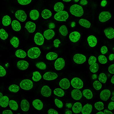 Histone H1 Monoclonal Mouse Antibody (HH1/957)