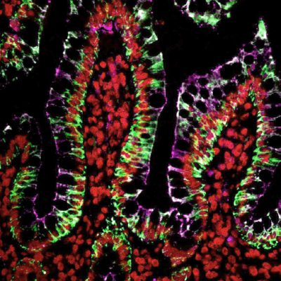 Histone H1 Monoclonal Mouse Antibody (HH1/957)