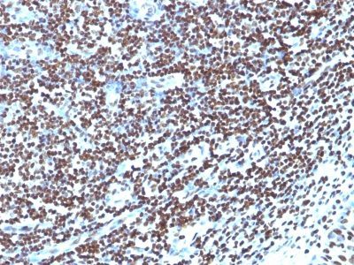 Histone H1 Monoclonal Mouse Antibody (HH1/957)