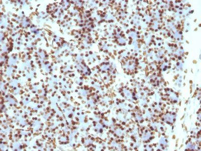 Histone H1 Monoclonal Mouse Antibody (HH1/957)