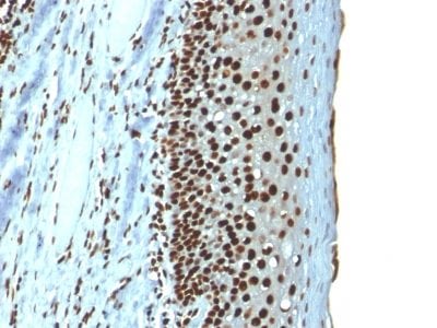 Histone H1 Recombinant Monoclonal Mouse Antibody (r1415-1)