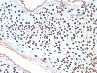 Histone H1 Recombinant Monoclonal Rabbit Antibody (AE-4)