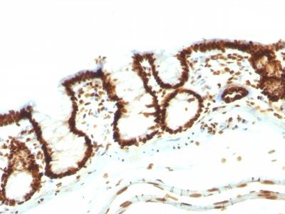Human Nuclear Antigen Monoclonal Mouse Antibody (NM106)