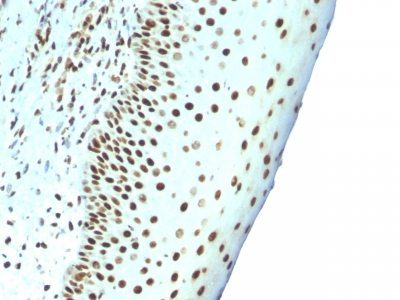 Human Nuclear Antigen Monoclonal Mouse Antibody (NM106)