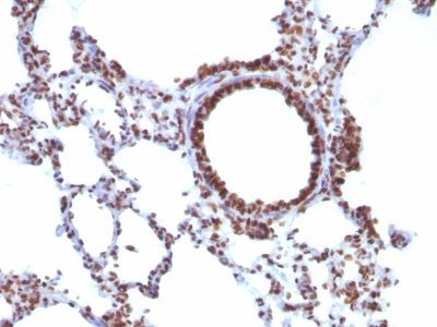 Human Nuclear Antigen Monoclonal Mouse Antibody (NM106)