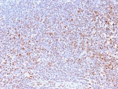 Nuclear Antigen Recombinant Monoclonal Rabbit Antibody (NM2984R)