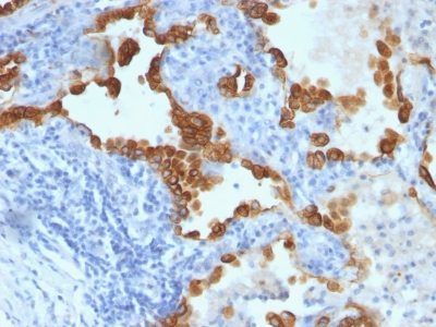 Nuclear Membrane Monoclonal Mouse Antibody (NM97)