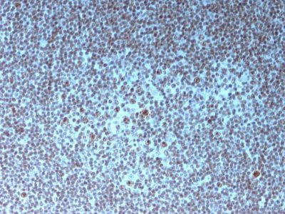 Nucleolar / Nucleoli Monoclonal Mouse Antibody (NM95)