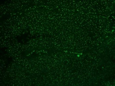 Nucleolar / Nucleoli Monoclonal Mouse Antibody (NM95)