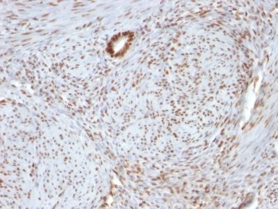 Nucleolin Monoclonal Mouse Antibody (364-5 + NCL/902)
