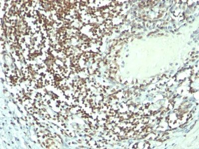 Nucleolin Monoclonal Mouse Antibody (364-5 + NCL/902)