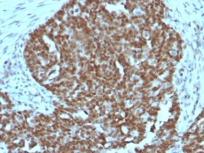 Nucleolin Monoclonal Mouse Antibody (364-5 + NCL/902)
