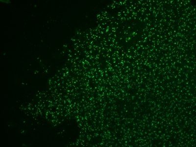 Nucleolin Monoclonal Mouse Antibody (364-5 + NCL/902)