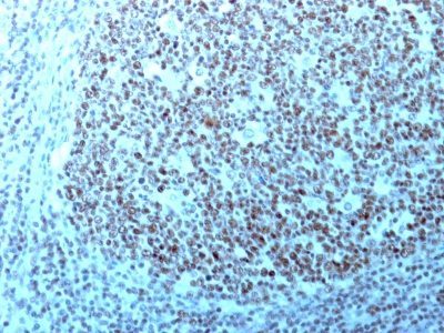 Nucleolin Monoclonal Mouse Antibody (364-5 + NCL/902)