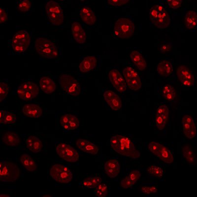 Nucleolin Monoclonal Mouse Antibody (364-5)