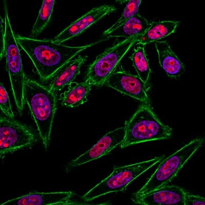 Nucleolin Monoclonal Mouse Antibody (364-5)