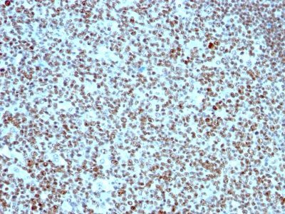 Nucleolin Monoclonal Mouse Antibody (364-5)