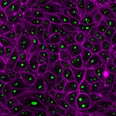 Nucleolin Monoclonal Mouse Antibody (364-5)