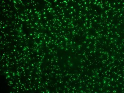 Nucleolin Monoclonal Mouse Antibody (364-5)