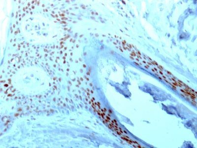 Nucleolin Monoclonal Mouse Antibody (364-5)